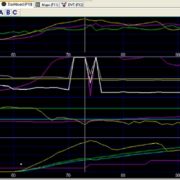 Much like a doctor reads an EKG, interpreting the results is a specialty skill.